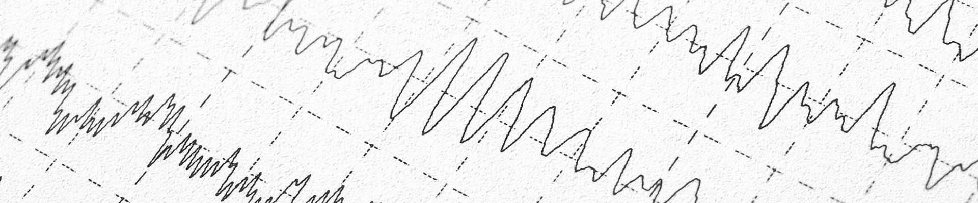 Brain waves printed out from an EEG machine during a sleep study.